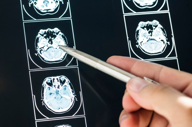 What is a CT Scan?