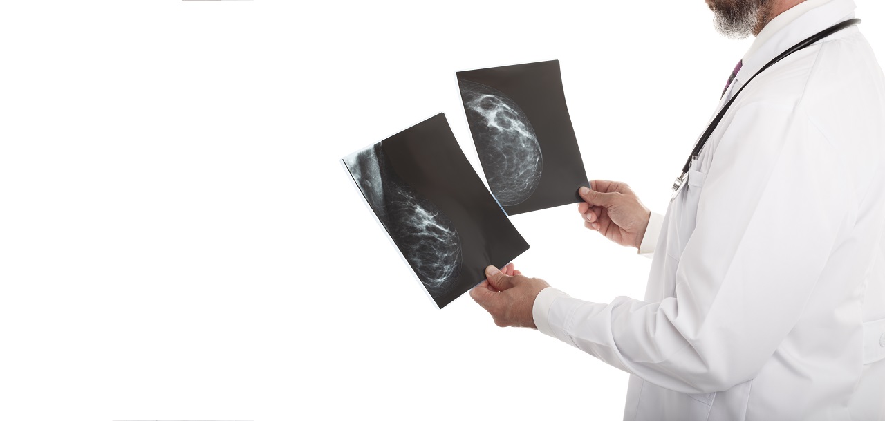 A doctor looking at mammographs
