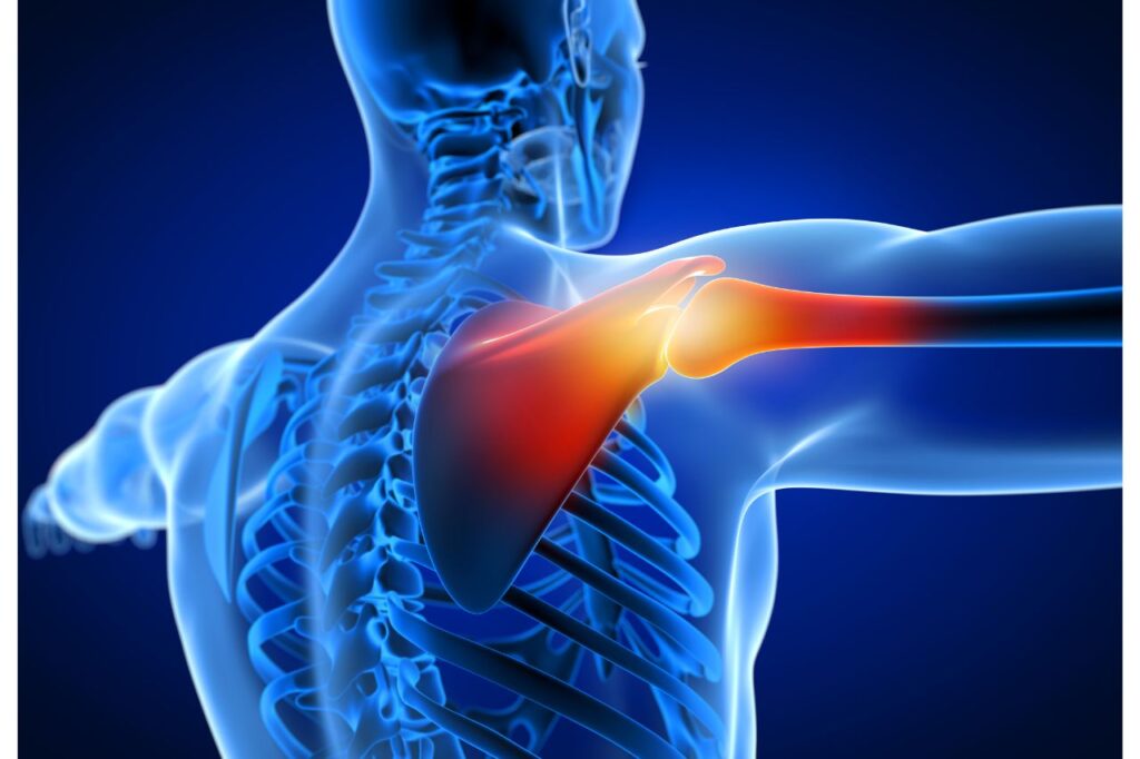 Everything You Need To Know About Osteoporosis Disease In The Philippines