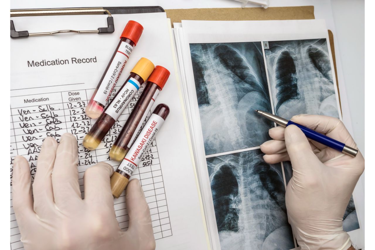 Chronic Lung Infections