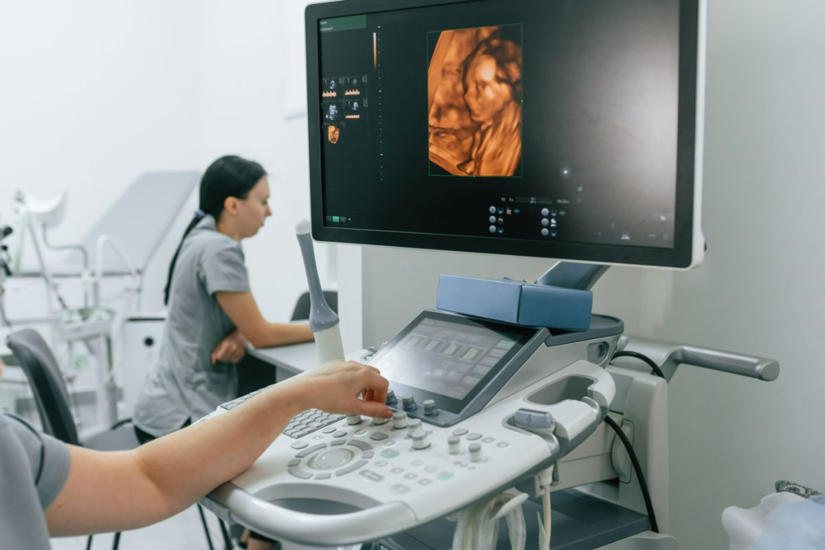 3D ultrasound